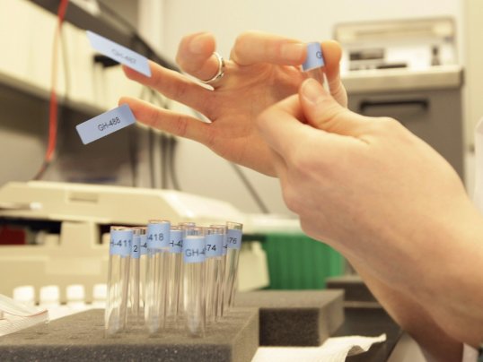 The Italian Olympic Committee (CONI) has announced that it has imposed a ban on Elena Giacomuzzi for doping.