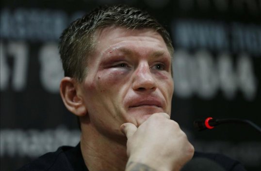 Ricky Hatton last night quit boxing, insisting he does not want to put his family through hell again.
