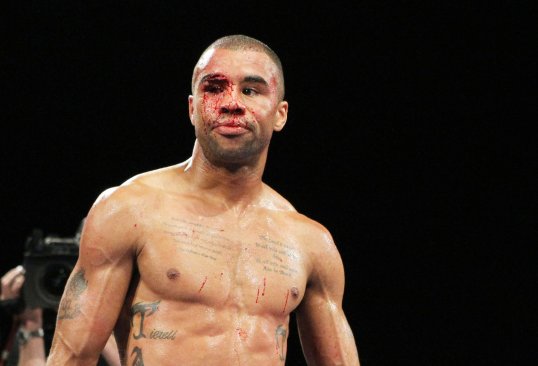 British super-bantamweight Rendall Munroe has admitted he is considering hanging up the gloves after his devastating loss to Scott Quigg.