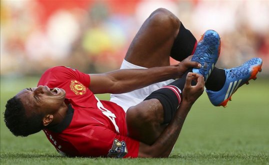 Manchester United winger Nani has said he expects the side to improve after they lost 2-1 at home to West Bromwich Albion.