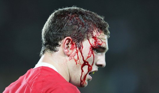 Wales winger George North has been cleared of serious injury ahead of the Six Nations.
