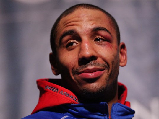 Super-middleweight WBA and WBC champion Andre Ward has revealed we will undergo surgery later this week.