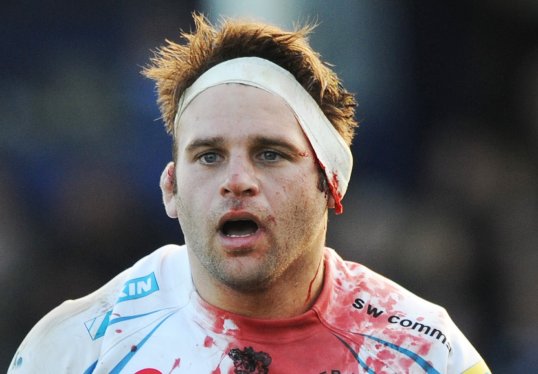 Exeter Chiefs head hooker Chris Whitehead has been ruled out of action for next three months with an on-going neck injury.